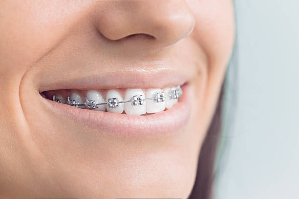 Why Choose Us for Your Dental Needs in New Haven, MO